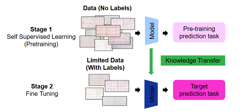 ECG foundation model